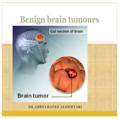 Benign brain tumours