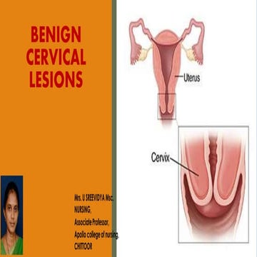 Benign lesions of cervix