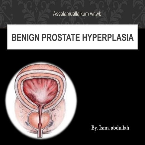 Benign prostate hyperplasia