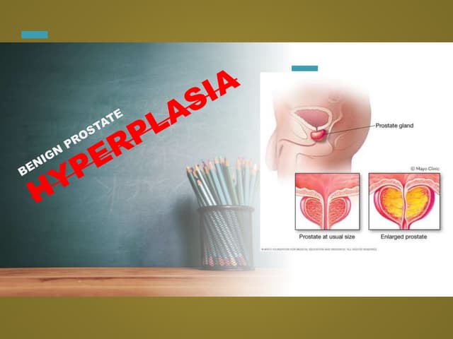 Benign prostatic hyperplasia (BPH) | PPTX
