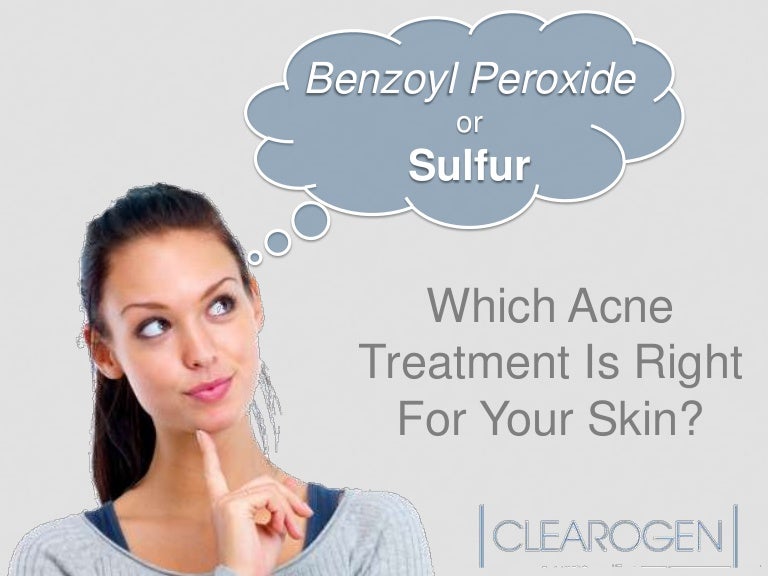 Benzoyl Peroxide or Sulfur Which acne treatment is right for your sk…
