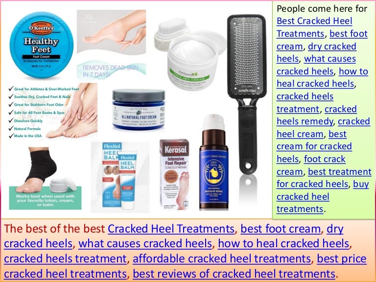 best foot cream for severely cracked heels