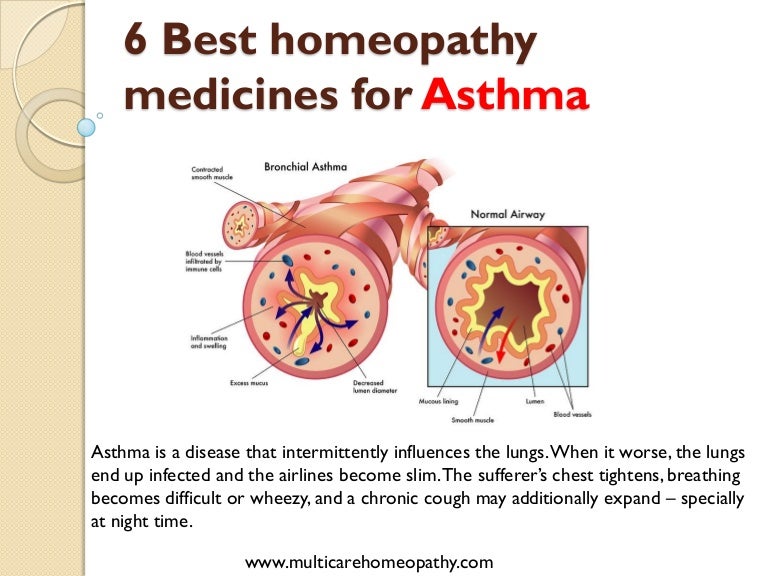 Top 6 homeopathy medicines for asthma