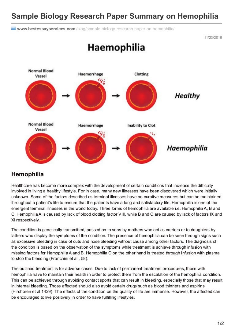 Hemophilia biology discussion image