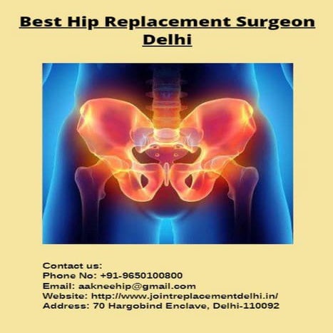 Best Hip Replacement Surgeon Delhi | PDF