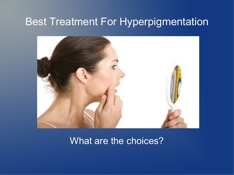 Best Treatment For Hyperpigmentation