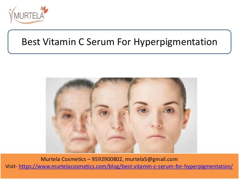 Best vitamin c serum for hyperpigmentation
