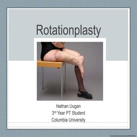 Rotationplasty
