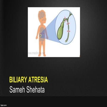 Biliary atresia simplified  