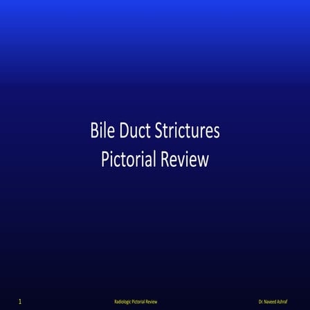 Biliary strictures
