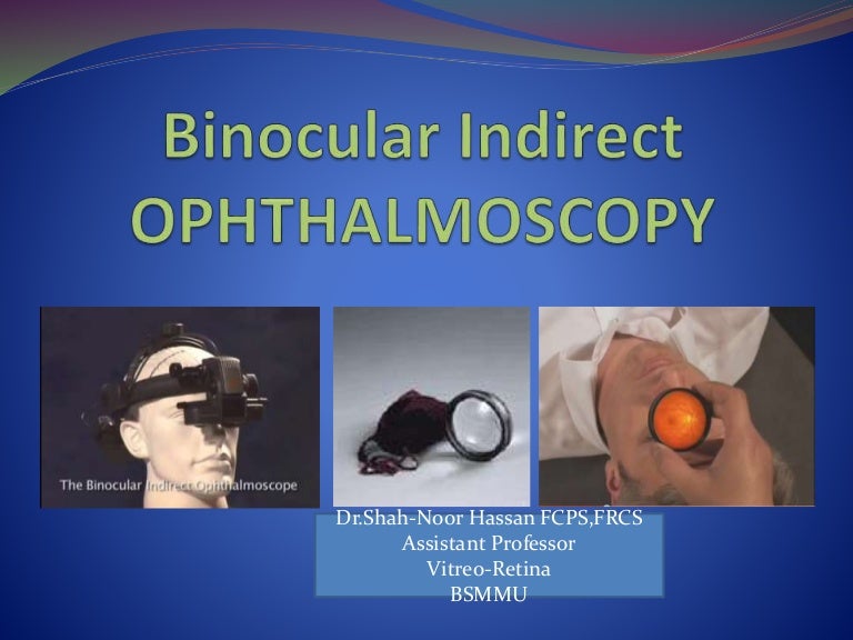 Binocular Indirect Ophthalmoscopy