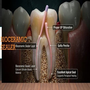 Bioceramic in dentistry ( Endodontics) | PPTX