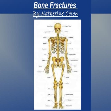 Bio fracture | PPT