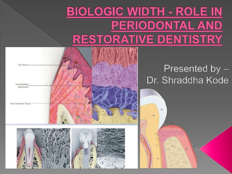 Biologic width Importance in Periodontal and Restorative Dentistry