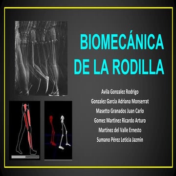 Biomecánica de la rodilla