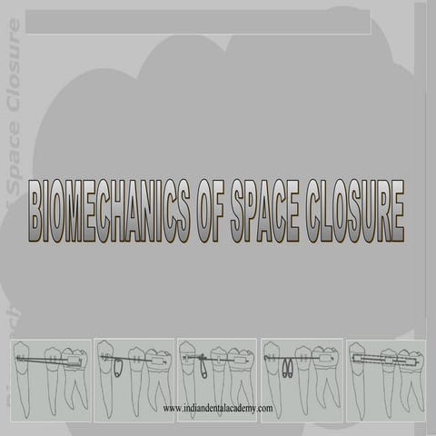 Biomech of space closure