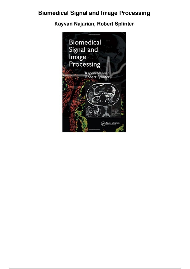 Biomedical signal and image processing pdf