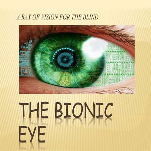 Bionic eye