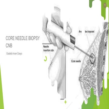 Teknik Operasi Biopsi Tumor (Core Biopsy, Incisi Biopsy, Excisi Biospsy ...