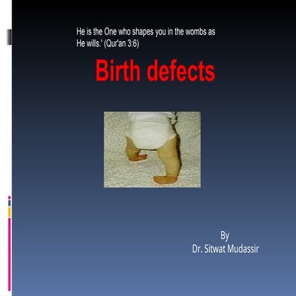 Birth Defects (EMBRYOLOGY - MBBS) by Dr. Sitwat.ppt