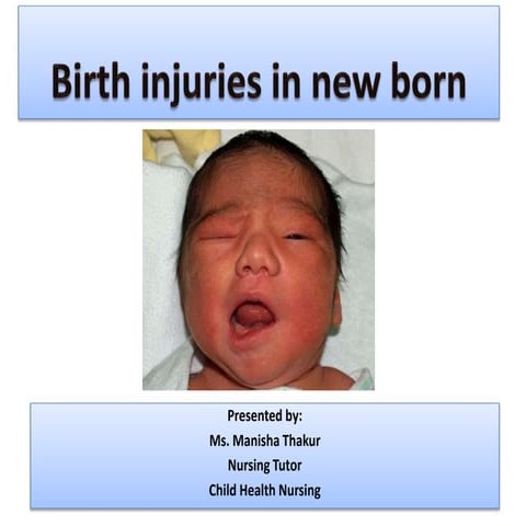 BIRTH INJURIES IN NEWBORN