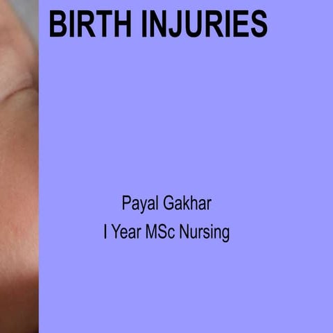birthinjuries.ppt