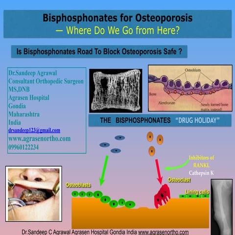 Bisphosphonates for osteoporosis where do we go from here? is ...