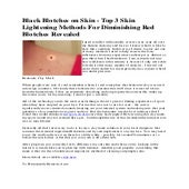 Black blotches on skin top 3 skin lightening methods for diminishing ...