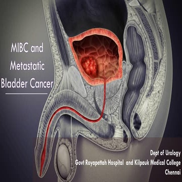 MIBC & Metastatic Urinary Bladder carcinoma