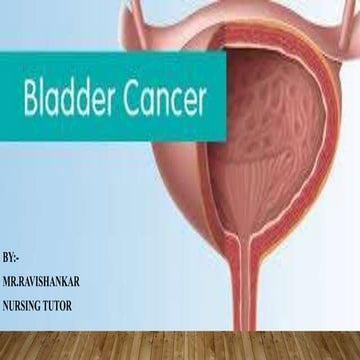 BLADDER CANCER.pptx