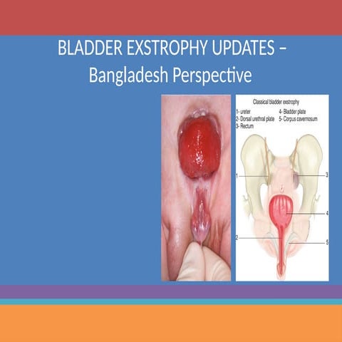 Bladder exstrophy or ectopia vescica | PPTX