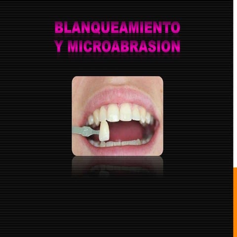 Blanqueamiento y microabrasion dental