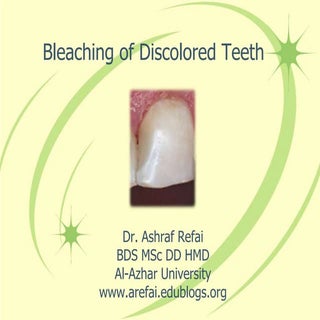 Bleaching Of Discolored Teeth