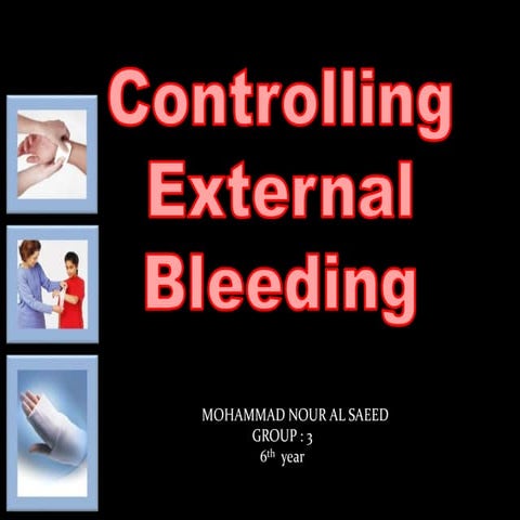 Controlling External Bleeding