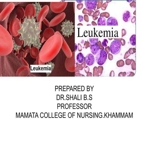Leukemia in children