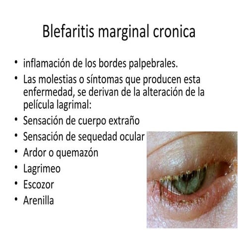 Blefaritis marginal cronica