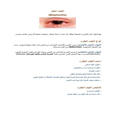 التهاب الجفن  .docx