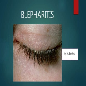 BLEPHARITIS ppt.pptx