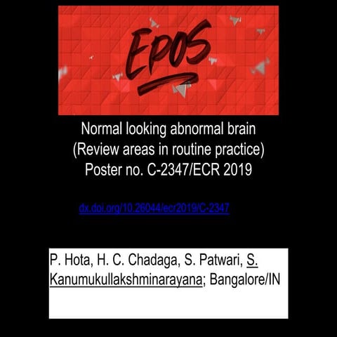 Blind spot in brain imaging 