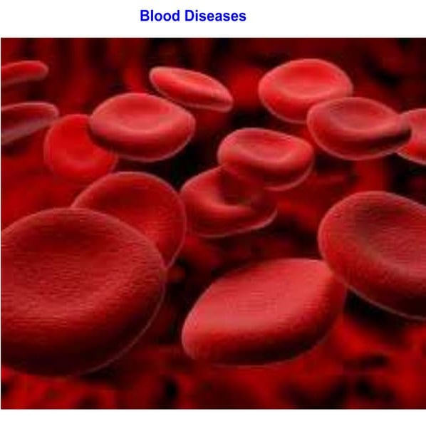 Blood diseases2