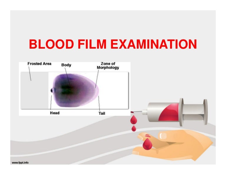 Blood film examination