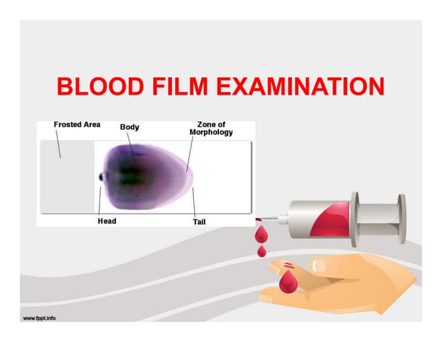 Blood film examination