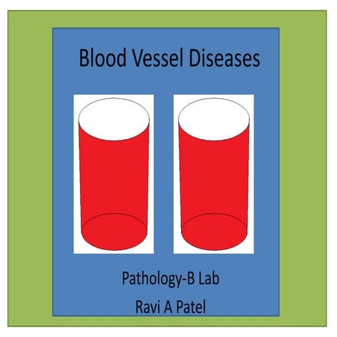 Blood Vessel Diseases