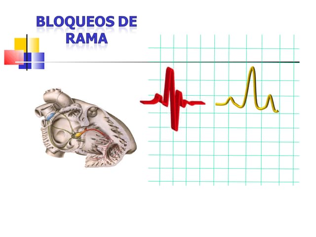 Bloq de rama