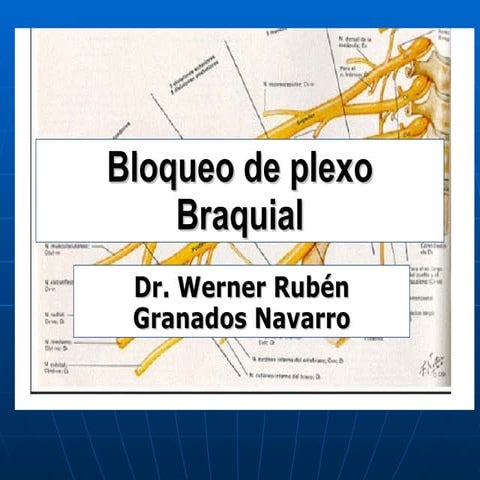 Bloqueo Del Plexo Braquial