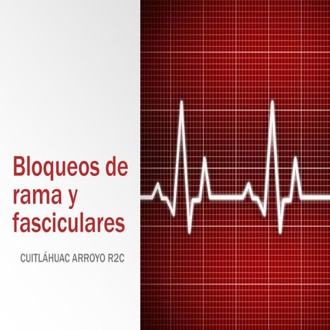 Bloqueos de rama y fasciculares. Electrocardiograma