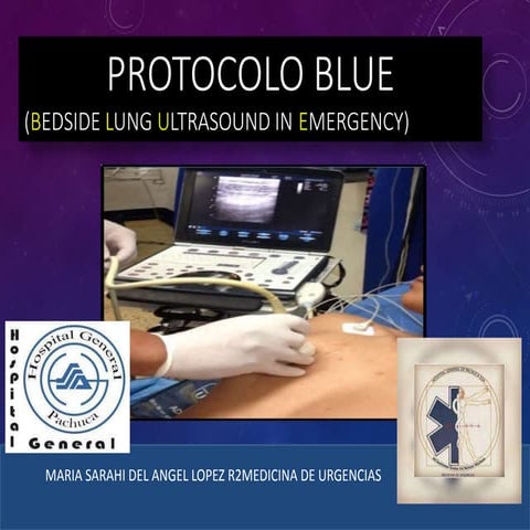 Blue protocolo | PPTX