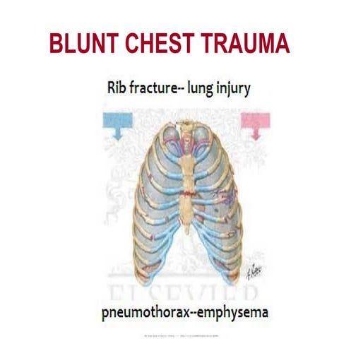 Blunt chest trauma with surgical emphysema - A case report