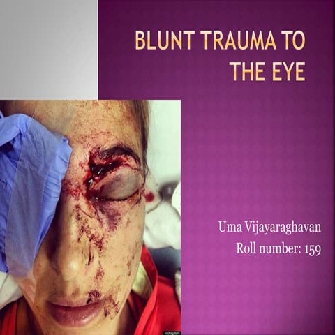 Blunt trauma to eye