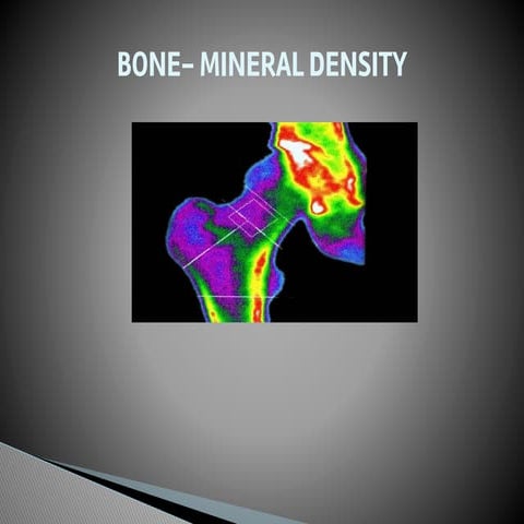 Bone marrow density (BMD)